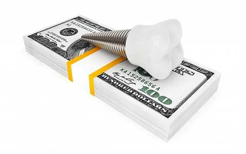 dental implant lying on top of a stack of money