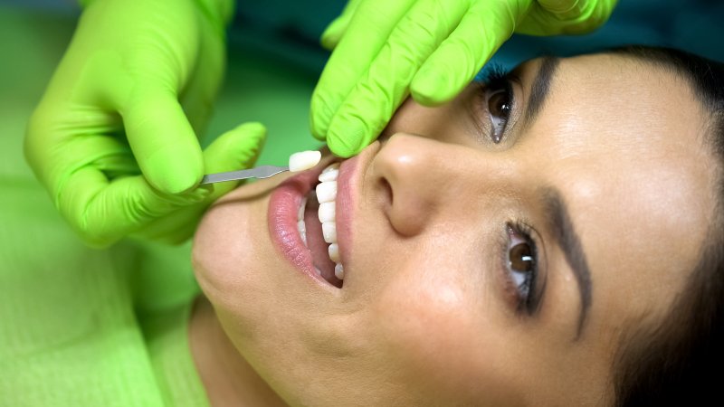 dentist placing a veneer in a patient’s smile