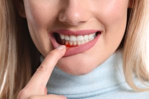 person with gum disease visiting cosmetic dentist in Corte Madera