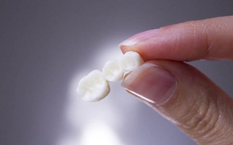 Close-up of hand holding dental bridge in Corte Madera, CA