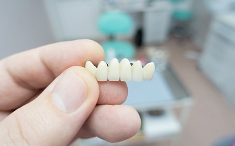 holding dental bridges in Corte Madera