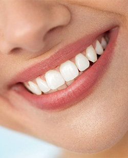 Closeup of a woman smiling